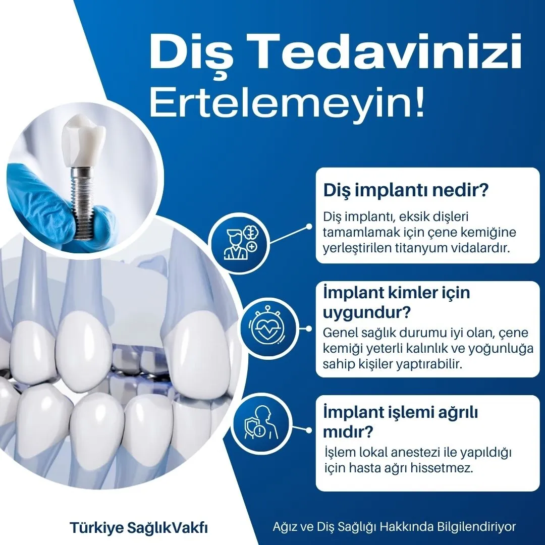 Diş İmplantı Hakkında Bilinmesi Gerekenler ve Sık Sorulan Sorular